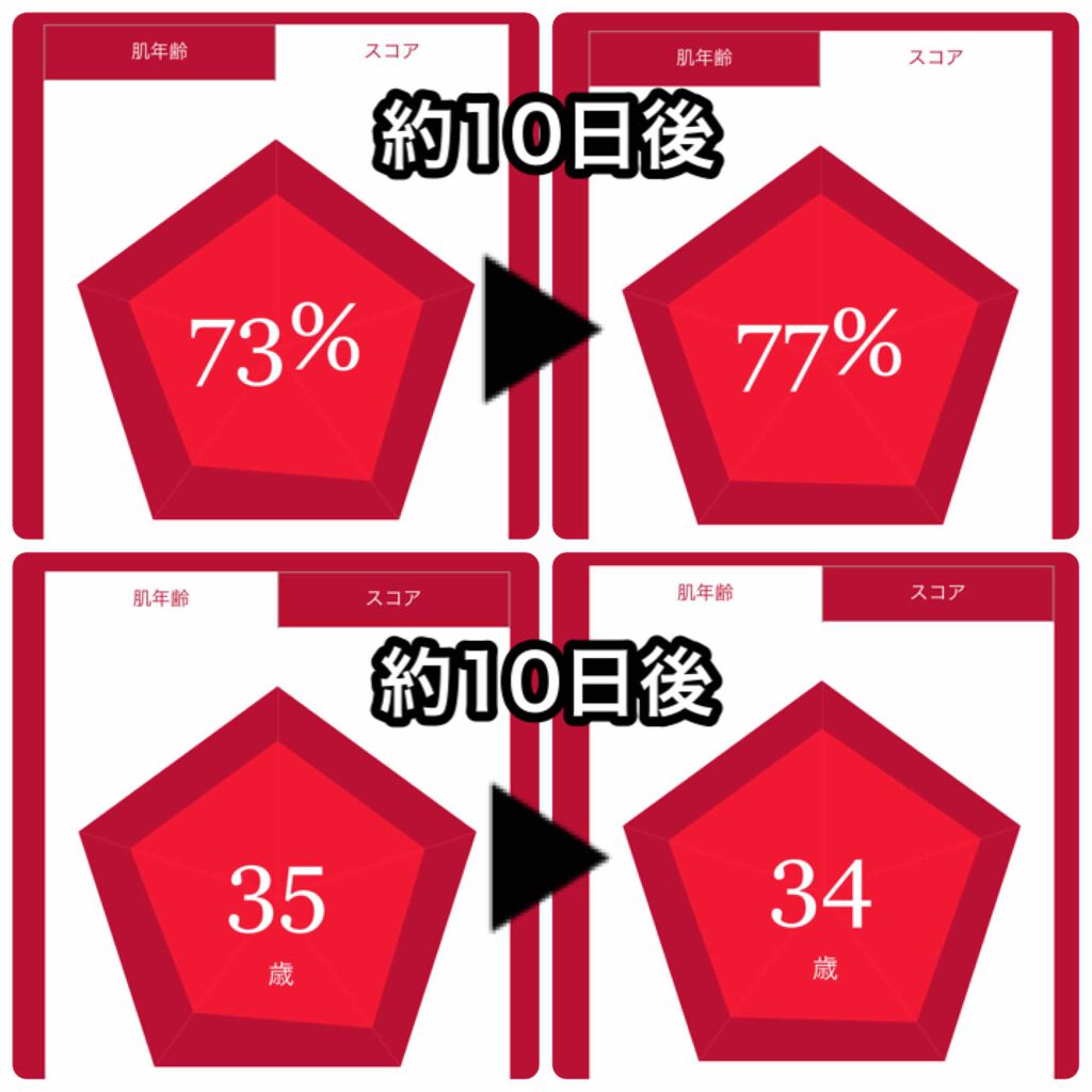 フェイシャル トリートメント エッセンス Sk Iiを使った口コミ サンプル使用期間を除いて 使用開始からちょ By Gaho がほ アトピー肌 Lips