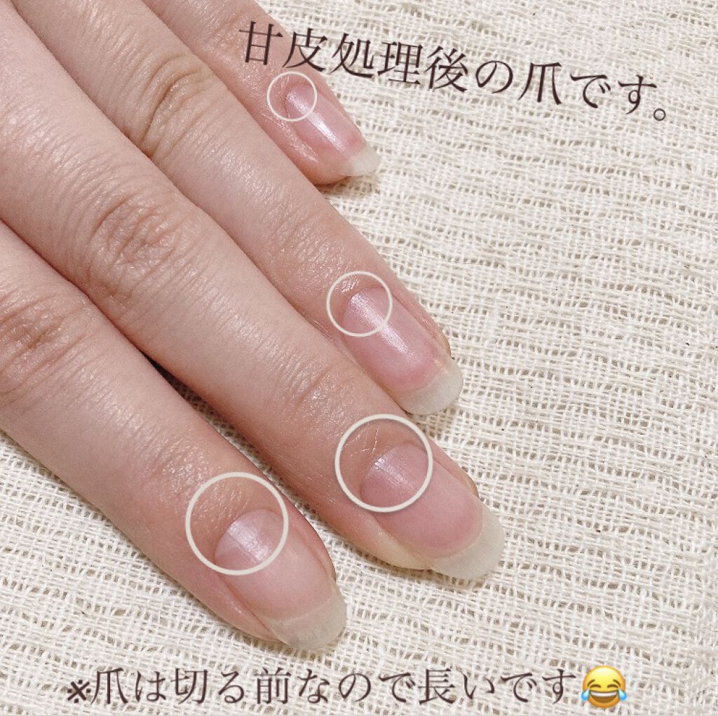 キューティクルトリマー デュカートを使った口コミ Jk考案垢抜け女子の大原則まとめ ໒ By あなめ 混合肌 10代後半 Lips