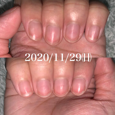 オイルインキューティクルプッシャーペン ビューティーワールドを使った口コミ 爪床伸ばしてみた 最後まで見てくれ By 𝑀𝐸𝑅𝑅𝑌 Lips