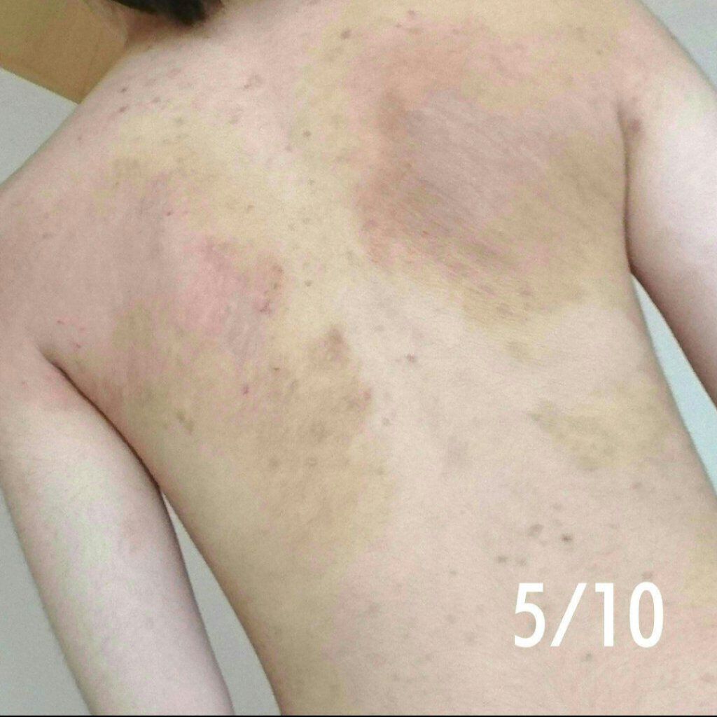 アットノンc Exクリーム 医薬品 アットノンの画像 動画一覧 Lips