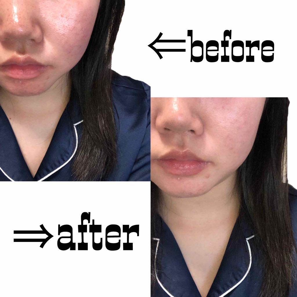 フェイスエディション プライマー フォーオイリースキン Ettusaisを使った口コミ 赤みが気になる肌によく効く 私の肌は By Ann 混合肌 10代後半 Lips