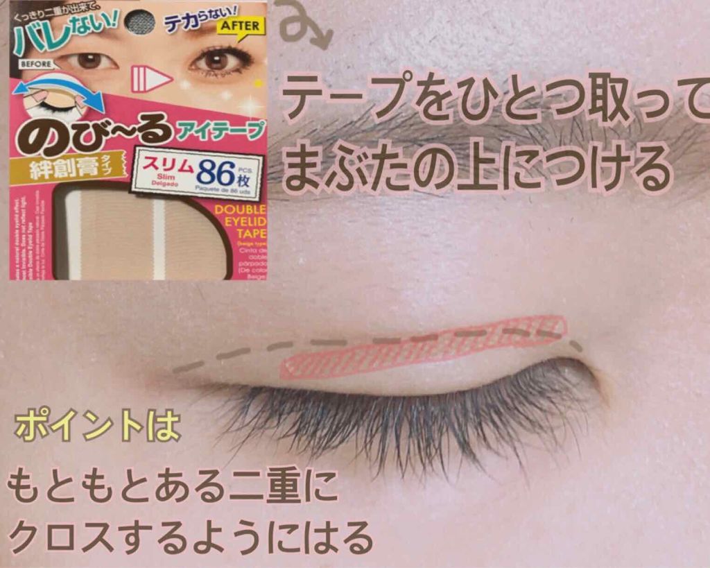のび る アイテープ 絆創膏タイプ Daisoの口コミ 超優秀 100均で買えるおすすめ二重まぶた用アイテム パッチリデカ目 二重 By まりくま Lips