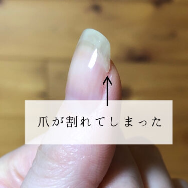 スプリットリペアn ネイルネイルの辛口レビュー ネイルネイルスプリットリペアnいいところ By Hekmatyar 代後半 Lips
