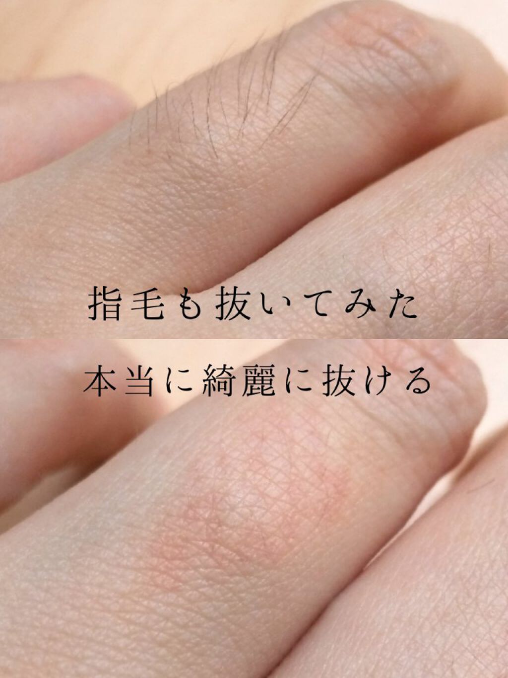 パーフェクトツイザー 貝印の口コミ 生えかけの短い毛や瞼に埋もれた毛までどん By いももち 毛穴 混合肌 代前半 Lips パーフェクトツイザー 貝印の口コミ 生えかけの短い毛や瞼に埋もれた毛までどん By いももち 毛穴 混合肌 代前半 Lips