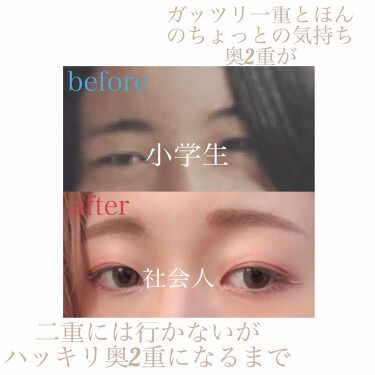 ダブルアイリキッド Abの口コミ 超腫れぼったい目を3年間アイプチ続けて何 By 新名 仕事の都合により更新ストップ中 アトピー肌 代前半 Lips