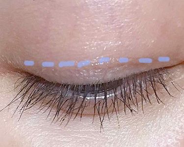 アイビューティーフィクサーwp アストレア ヴィルゴの口コミ アイプチするときは とにかく バレたくない By らん Lips