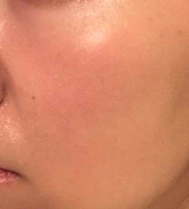 あなたはどっち派 Mimc Vs エトヴォス リキッドファンデーションを徹底比較 注意 肌の写真が有り By Aika 敏感肌 30代前半 Lips