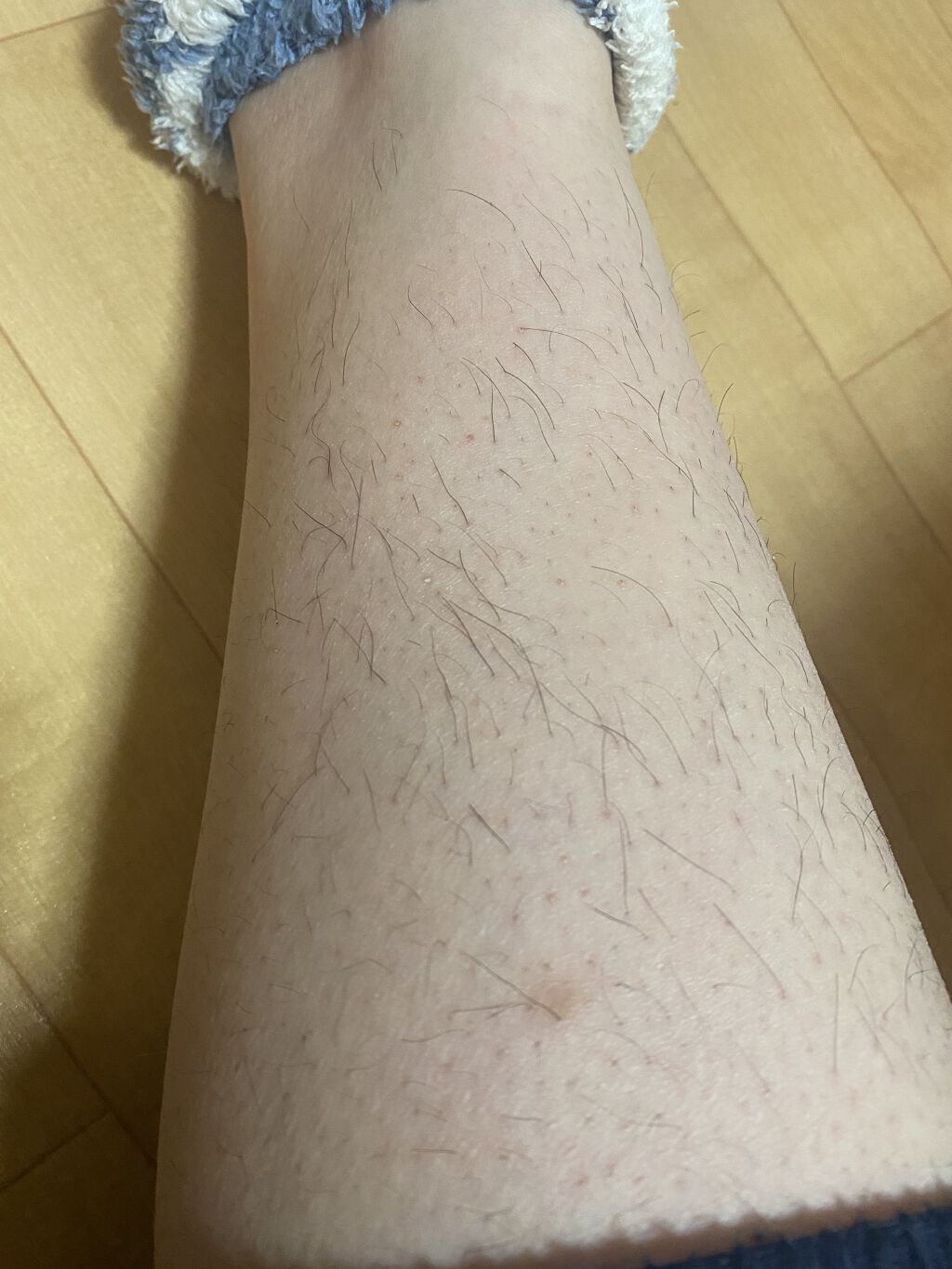 乳液 敏感肌用 高保湿タイプ 無印良品を使った口コミ お見苦しい濃いムダ毛の脚を出してしまい申し By Kurousagi 乾燥肌 30代前半 Lips