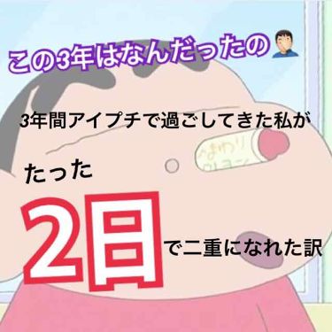 のび る アイテープ 絆創膏タイプ Daisoの口コミ 超優秀 100均で買えるおすすめ二重まぶた用アイテム ずっと片方だけ一重でず By ぴろ 10代後半 Lips