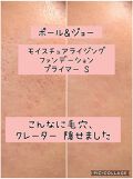 クレーター 話題沸騰中のコスメ 真似したいメイク方法の口コミが53件 デパコスからプチプラまで Lips