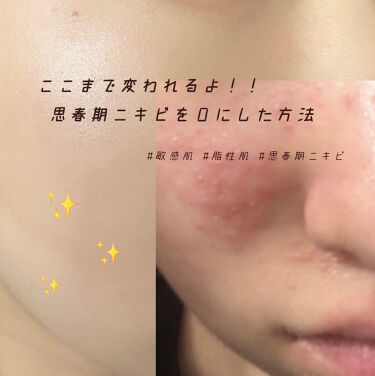 年代 肌質別 潤浸保湿 乳液 Curelの口コミ 441件 Lips