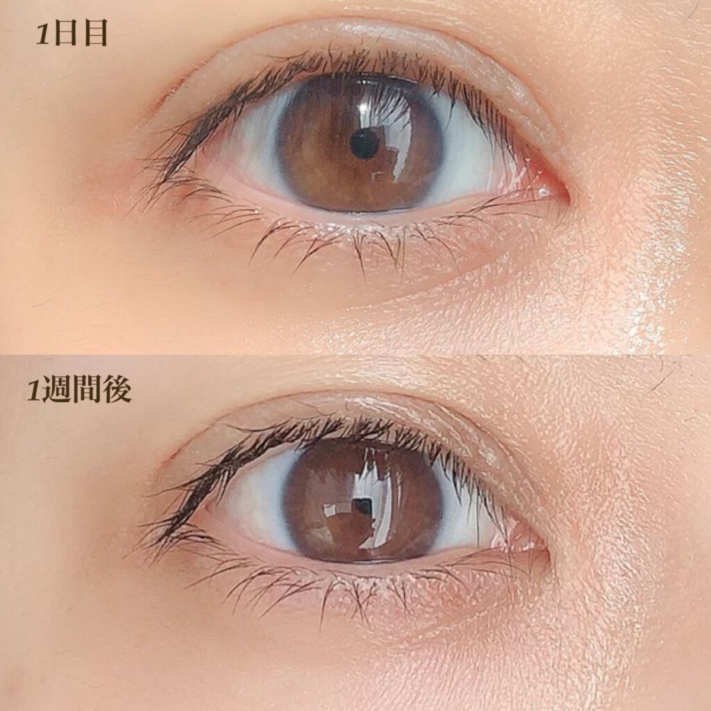 ザ リンクレス One By Koseの口コミ 経過報告 3枚目は目がたくさん写ってる By Mina 85 敏感肌 30代後半 Lips