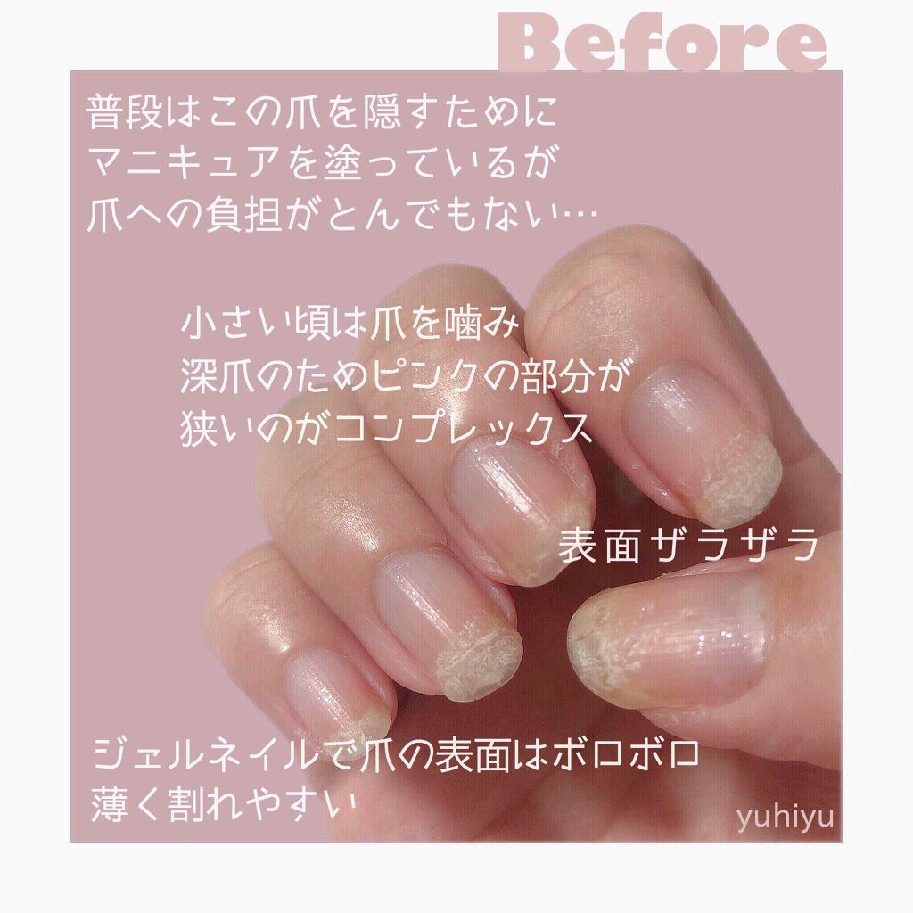 カラフルネイルズ キャンメイクの口コミ 割れやすい爪ともおさらば Canma By ゆうひちゃん 絵描き 乾燥肌 Lips