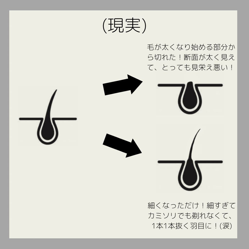 除毛クリームキット敏感肌用 エピラットの辛口レビュー こんにちは 今回は美容で失敗した話をします By りはプチプラ理系女子 混合肌 Lips