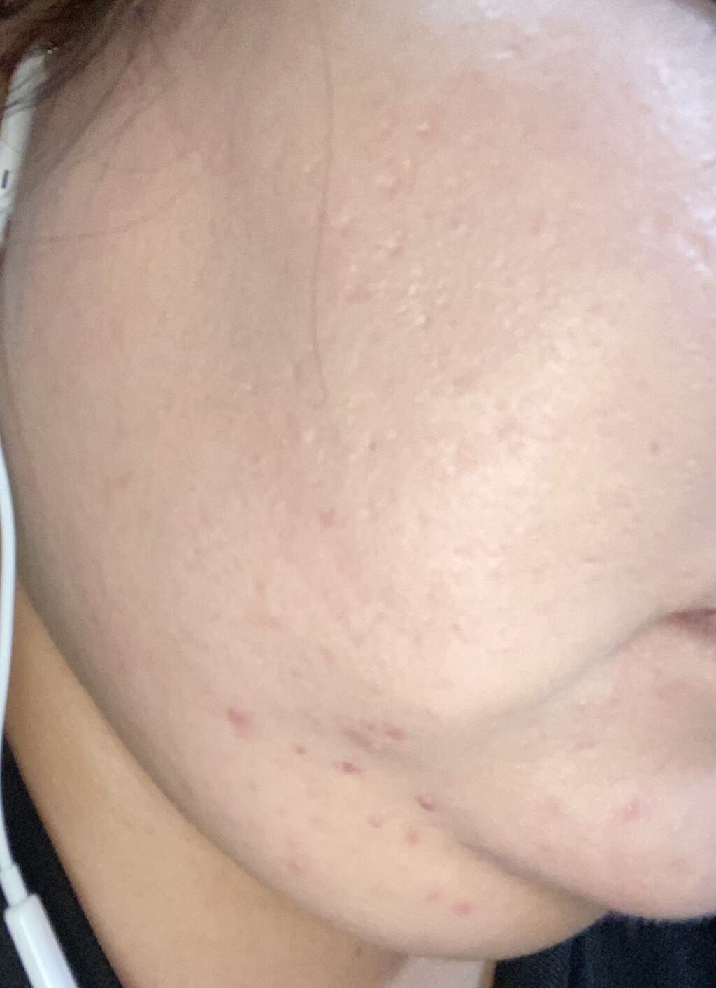 マーメイドスキンジェルuv キャンメイクを使った口コミ 汚い肌 閲覧注意 今回は 実験になりまーす By Mona 混合肌 Lips