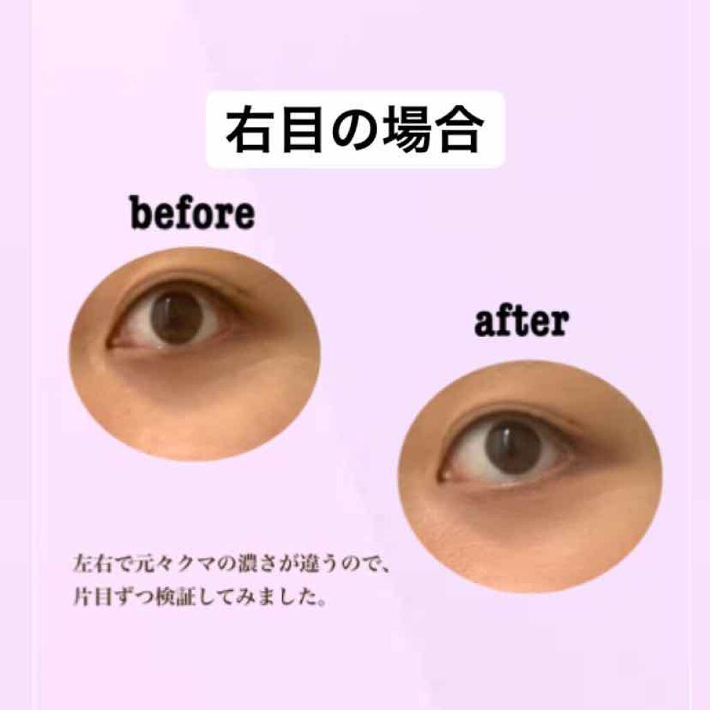 アドバンスド スムージング コンシーラー Threeの口コミ クマ消し ナチュラルで肌に優しいコンシー By 彩ひな 混合肌 代前半 Lips