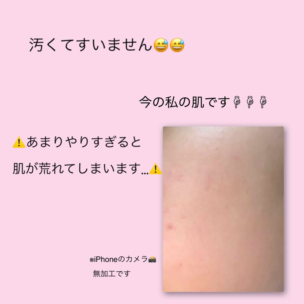 スキンケア方法 ロゼットゴマージュ モイスト ロゼットの使い方 効果 毛穴徹底ケア こんにち By 味醂 混合肌 10代後半 Lips