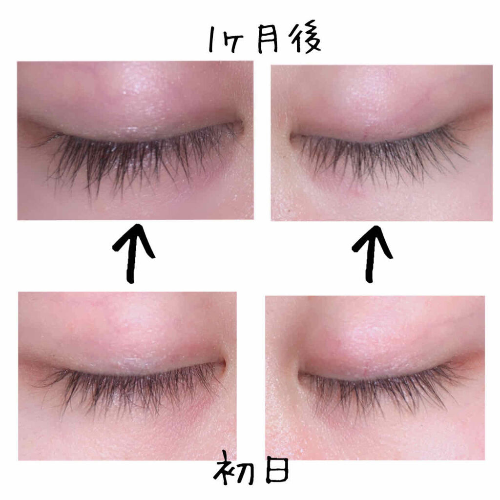 Emaked エマーキット 水橋保寿堂製薬の口コミ エマーキットのご説明 価格5 50 By あずさ 混合肌 Lips