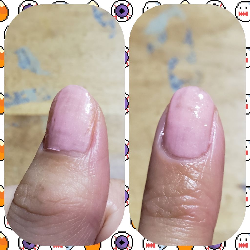 イットネイル パラソル クイックドライトップコート It Nailの辛口レビュー 薬局で安くなっていたので購入しました さら By 陣野 アトピー肌 代前半 Lips