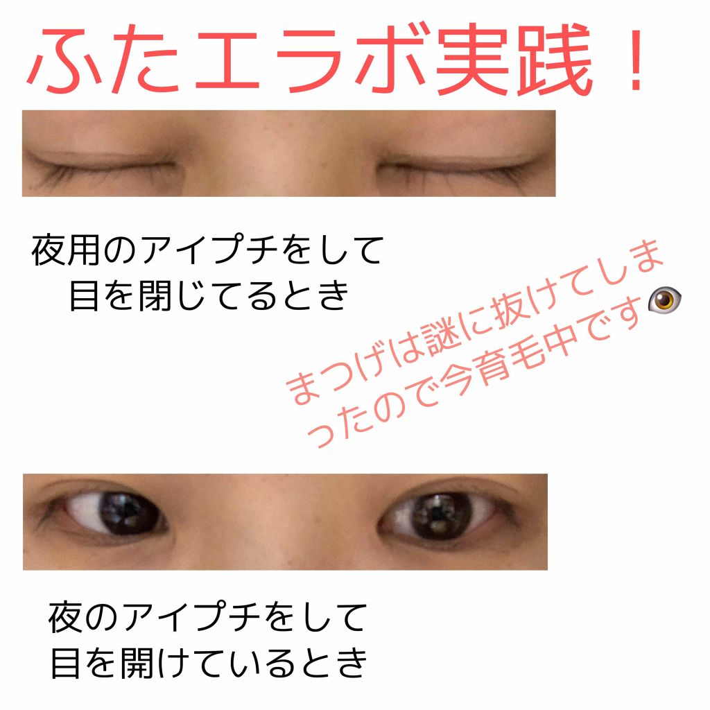 フタエラボ ナイトアイリッドグルー K Paletteの口コミ ふたえラボ使ってみました 感想を正直綴って By あおぞら 乾燥肌 10代後半 Lips