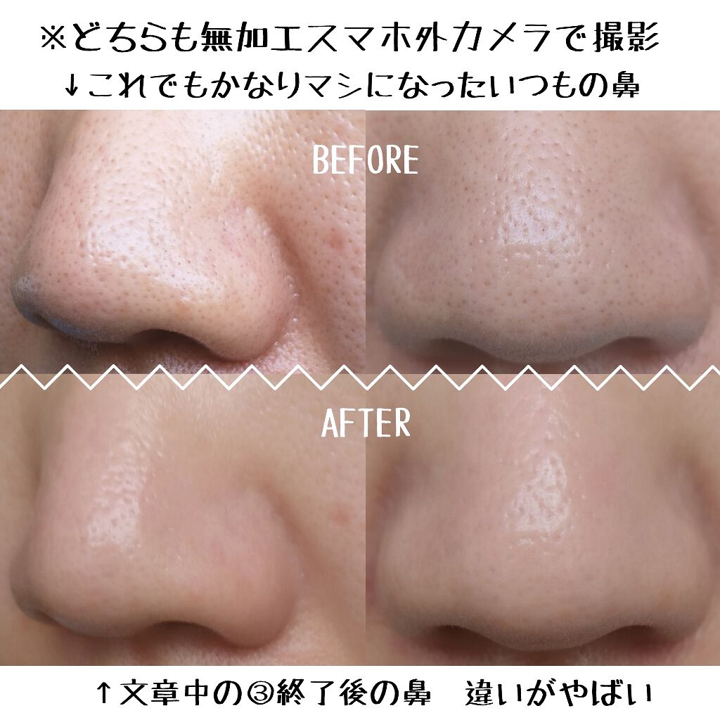 スキンケア方法 キールズ レアアース マスク Kiehl Sの使い方 効果 こんにちは ゆきです By ゆき 乾燥肌 Lips