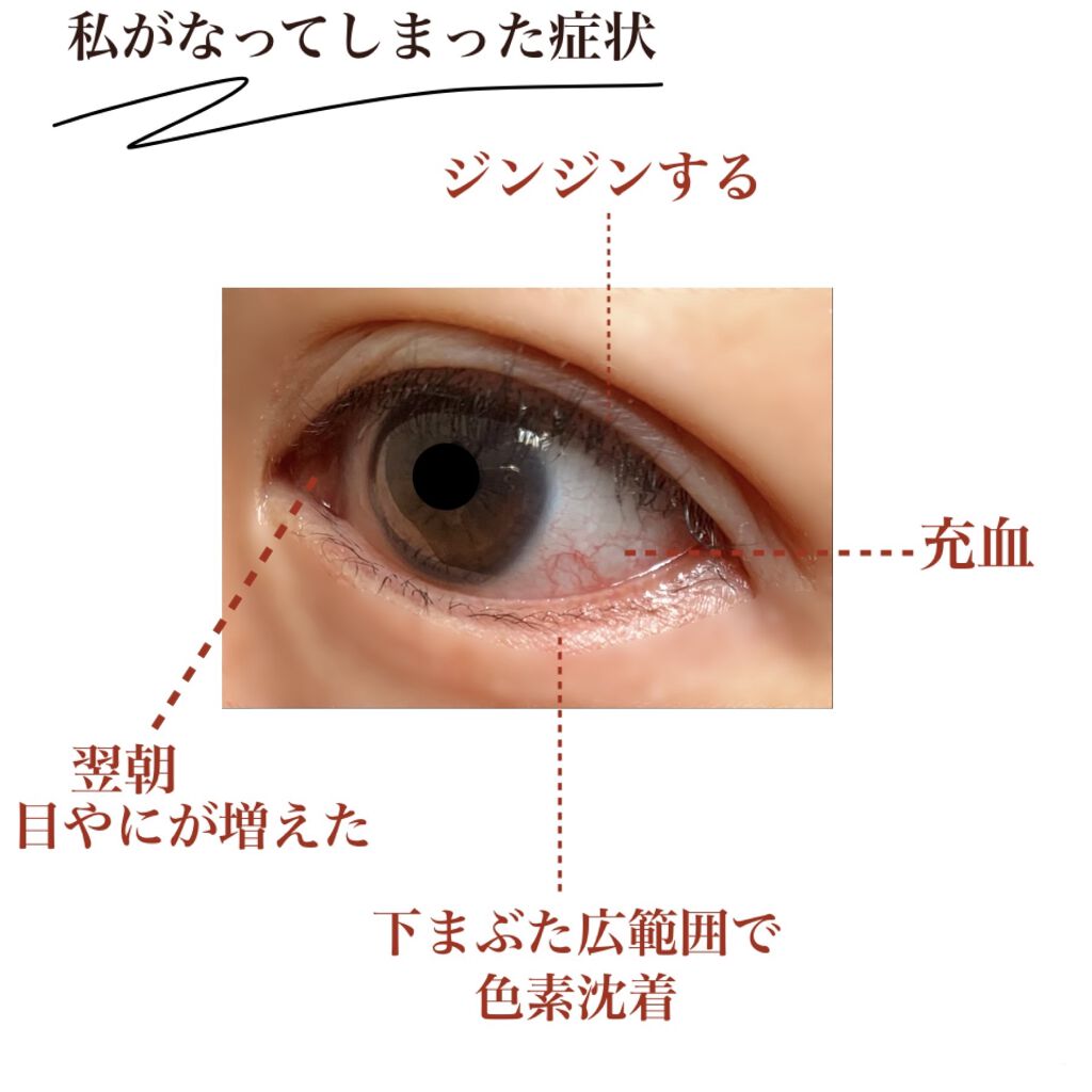 Emaked 水橋保寿堂製薬の効果に関する口コミ 𓂃𓈒𓏸いつもイイネありがとうニダ By 𝑺𝒆𝒖𝒏𝒈𝒎𝒊𝒏 𝒎𝒊 スンミン 混合肌 代後半 Lips