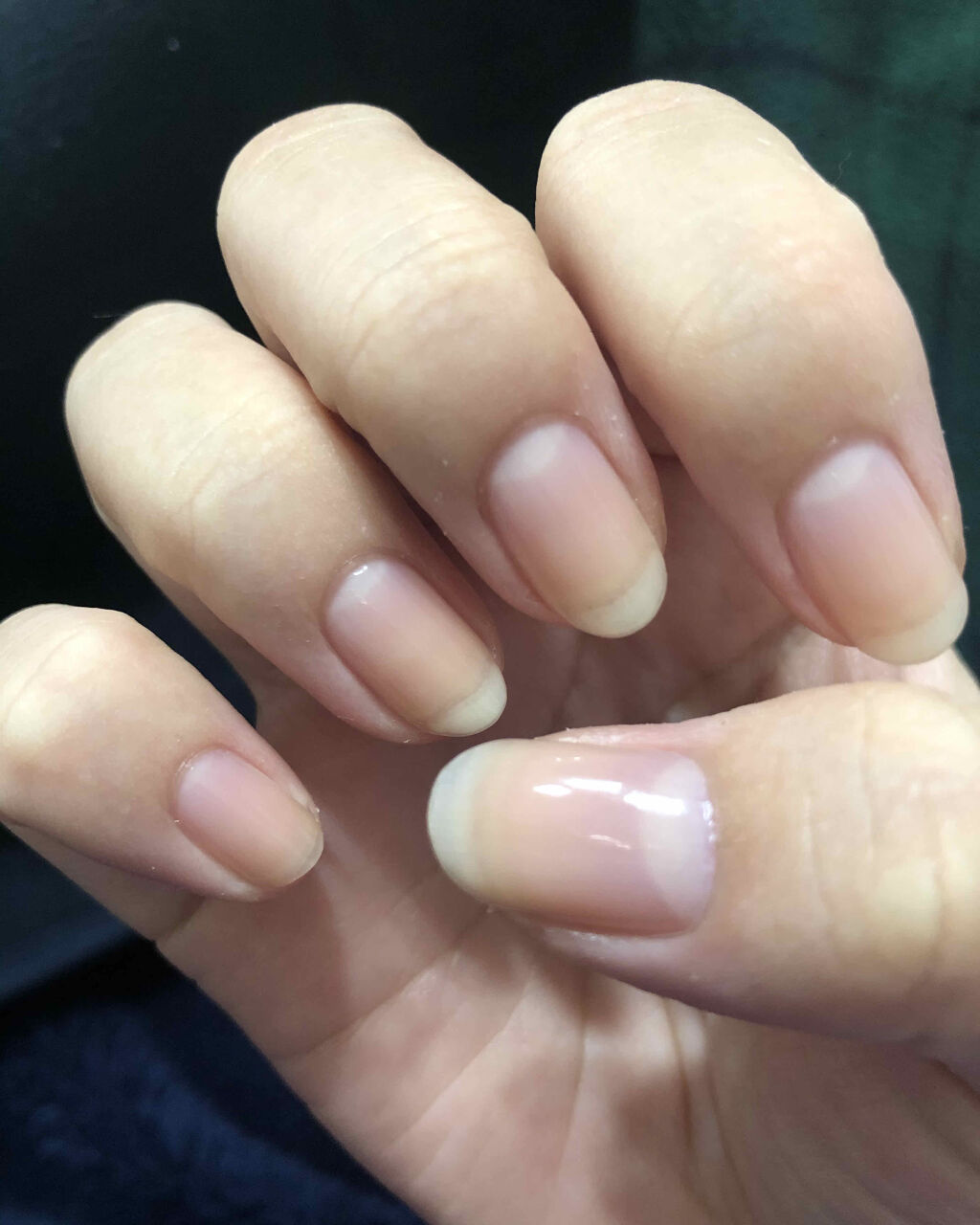 ニベアクリーム ニベアを使った口コミ 爪活報告 前回のを投稿して3ヶ月くらい By みみみ 乾燥肌 代前半 Lips