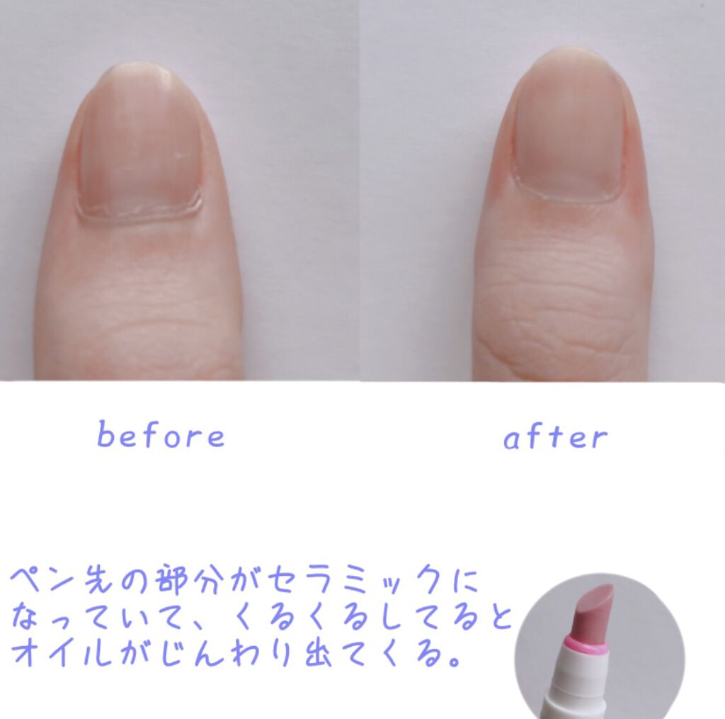 オイルインキューティクルプッシャーペン ビューティーワールドの使い方を徹底解説 甘皮を今まで処理したいと思ってはいたのです By 乾燥肌 Lips
