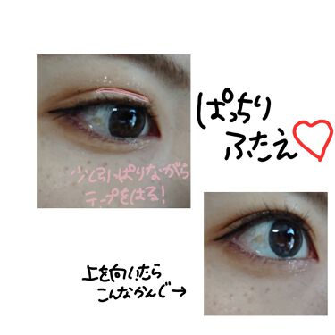 ふたえテープ 目立たず肌になじむ絆創膏タイプ Daisoの口コミ 超優秀 100均で買えるおすすめ二重まぶた用アイテム 片目だけ二重 もう片方 By なっち 23 乾燥肌 代前半 Lips