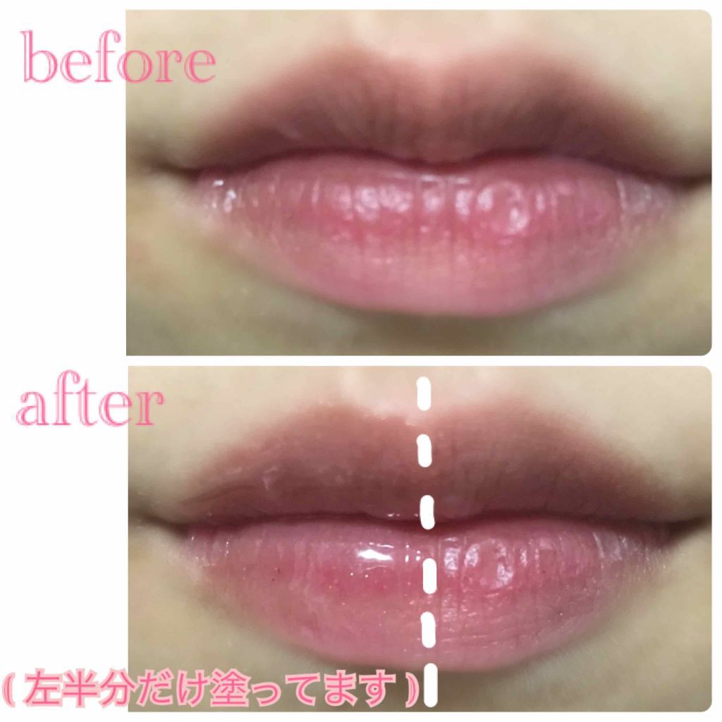 ボリュームアップレディグロス キャンメイクの口コミ キャンメイクボリュームアップレディグロス前 By Mira 乾燥肌 10代後半 Lips
