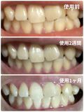 試してみた リステリン ホワイトニング リステリンのリアルな口コミ レビュー Lips
