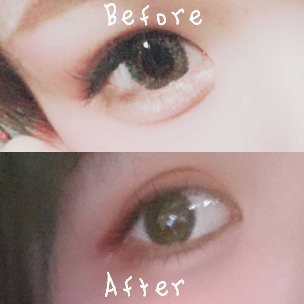 二重整形の口コミ 皆様こんにちは える です 今日は 二 By える 代前半 Lips