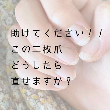 グロッシーコート スキューズミーの口コミ 二枚爪の直し方についてお見苦しくてすみませ By Tomy 一重 乾燥肌 Lips