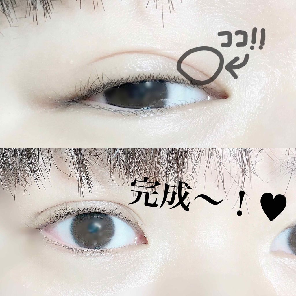 のび る アイテープ 絆創膏タイプ Daisoの口コミ 超優秀 100均で買えるおすすめ二重まぶた用アイテム 今日投稿しようと思 By ゴリゴリのイエベ 代前半 Lips