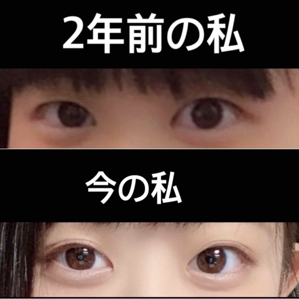 のび る アイテープ 絆創膏タイプ Daisoの使い方を徹底解説 超優秀 100均で買えるおすすめ二重まぶた用アイテム こんにちは ちいと申し By ちぃ Lips