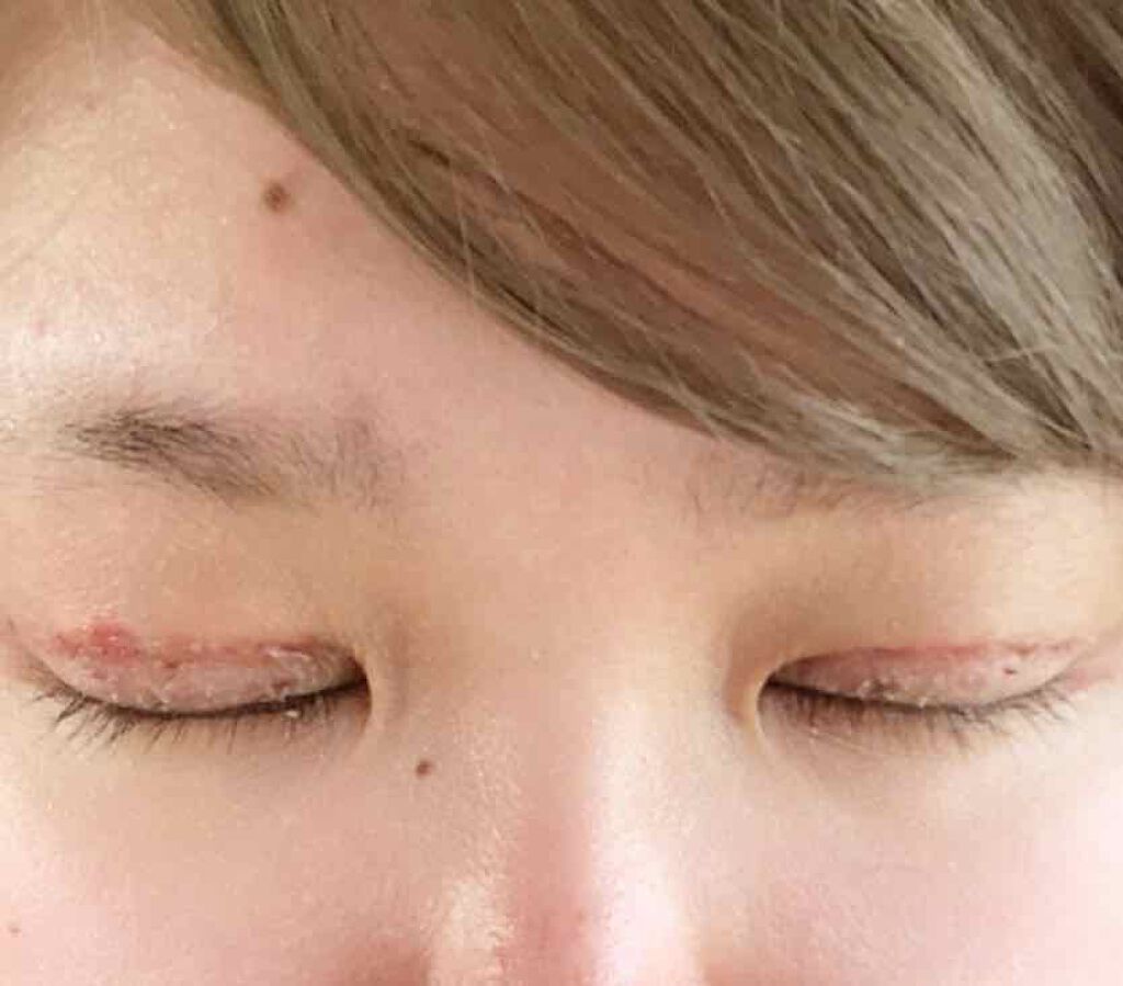 二重整形の口コミ 初めに 私はとくにいいねを求めてもいなくバ By S S 敏感肌 Lips