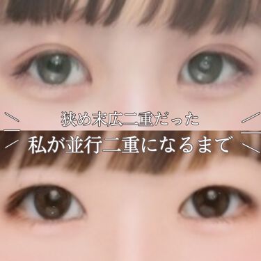 二重になる方法 のび る アイテープ 絆創膏タイプ Daisoの使い方や二重メイク 末広二重 並行二重こ By 神楽 乾燥肌 10代後半 Lips