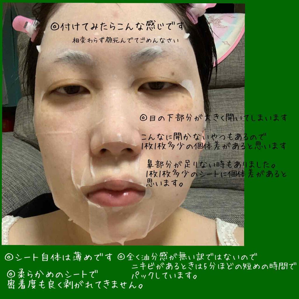 Cica デイリー スージング マスク Vt Cosmeticsの効果に関する口コミ Qoo10 By ばにらうさぎ ʚ ɞ 混合肌 代後半 Lips