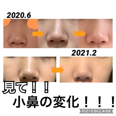 年代 肌質別 鼻クリップ ロフトファクトリーの口コミ 33件 Lips
