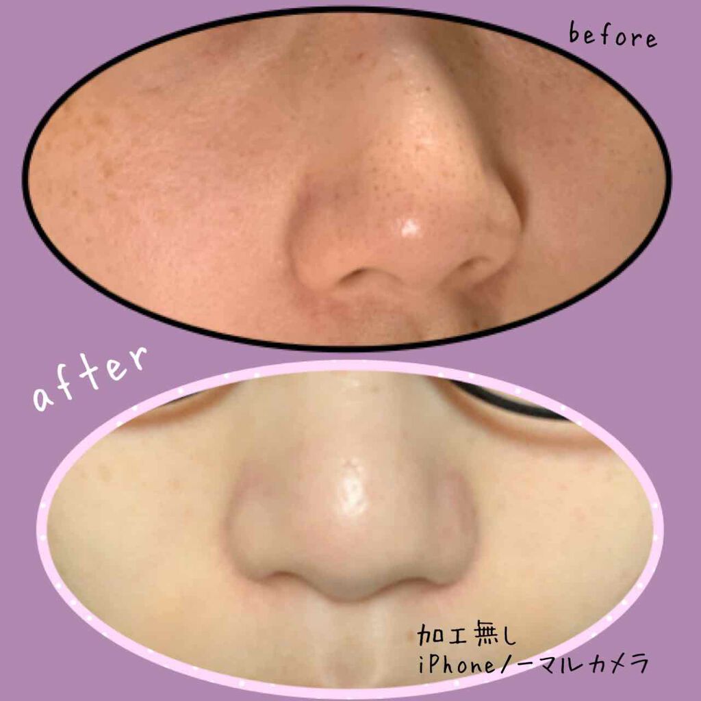 スキンケア方法 アミノ酸せっけん洗顔フォーム 旧 M Mark Seriesの使い方 効果 毛穴の黒ずみや角栓が気 By ばにらうさぎ ʚ ɞ 混合肌 代後半 Lips