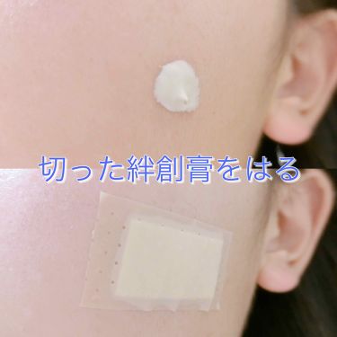 びふナイト 小林薬品の口コミ わたしのにきびの治し方 使うもの ビ By とこ 敏感肌 10代後半 Lips