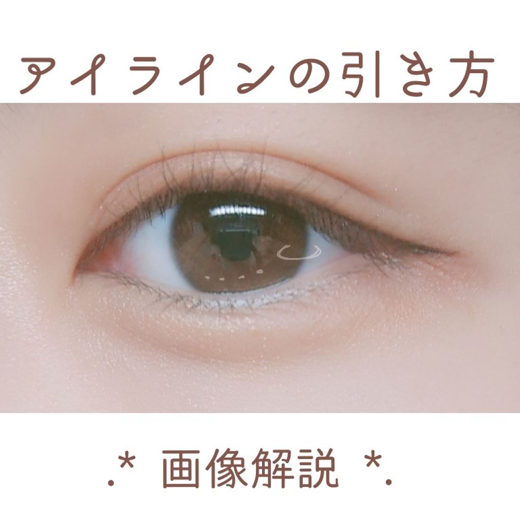 平行型