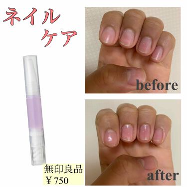 ネイルケアオイル 無印良品の口コミ 無印良品のネイルケアが最高 Lipsを見 By めろ 毎日投稿 普通肌 代前半 Lips