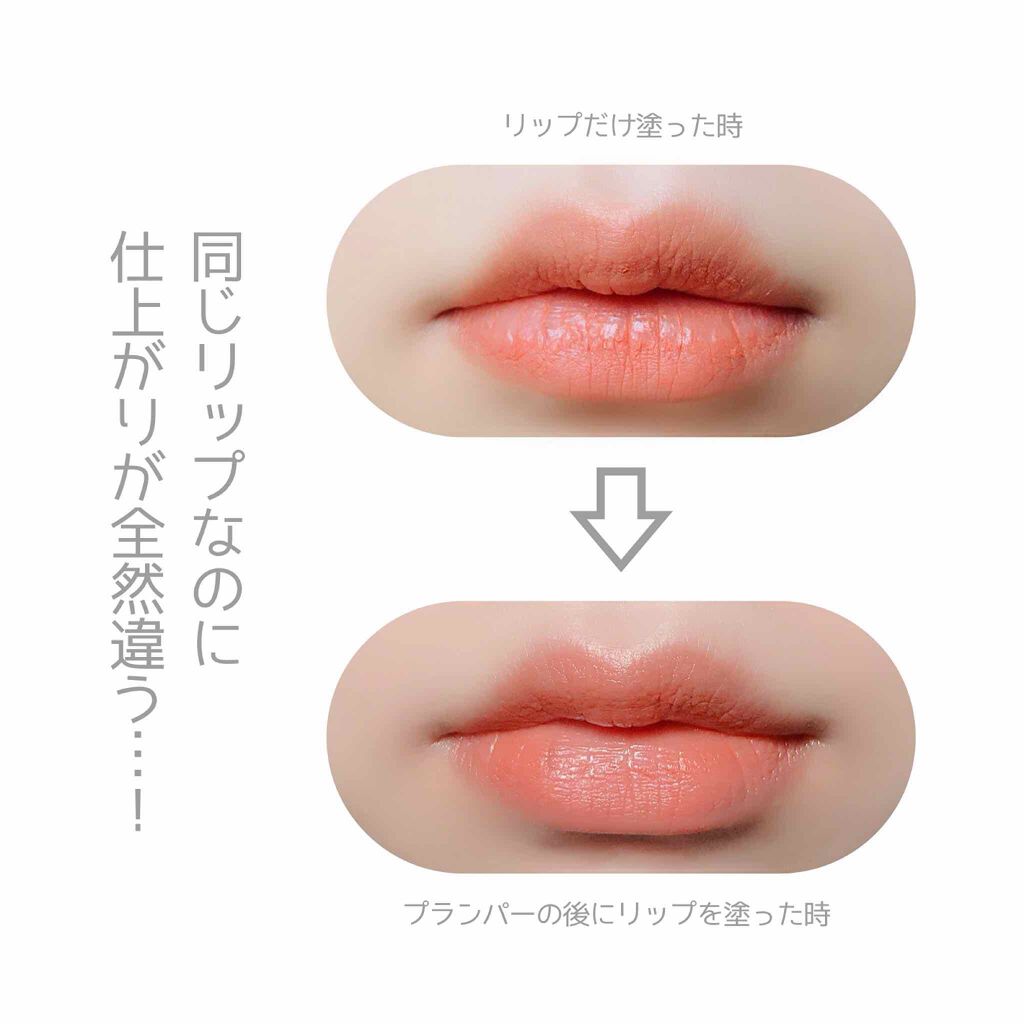 リッププランパーエクストラセラム Boricaの口コミ 私のガサガサ 皮むけした唇にハリとなめらか By まいたけ 乾燥肌 代前半 Lips