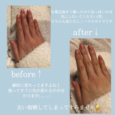 白ゆび姫 Himecotoの口コミ 白くて綺麗な指になりたい そんな方におすす By ゆにゆに 10代後半 Lips