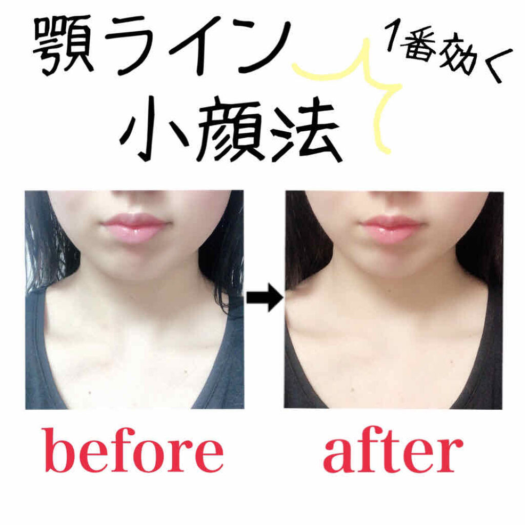 パーフェクトvリフティングプレミアムプラスマスク Avajarの効果に関する口コミ 私が愛用しているリフティング小顔マスク 3 By Momo 混合肌 代前半 Lips