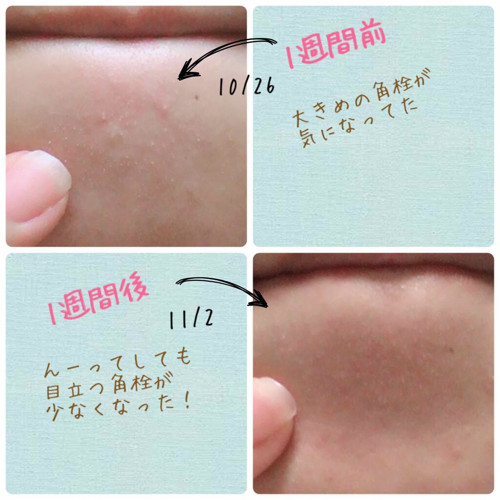 ファストシリーズ ミラクルクレンジング Kooを使った口コミ Kooで1週間夜だけ美容断食生活してました By すもも フォロバ100 混合肌 Lips