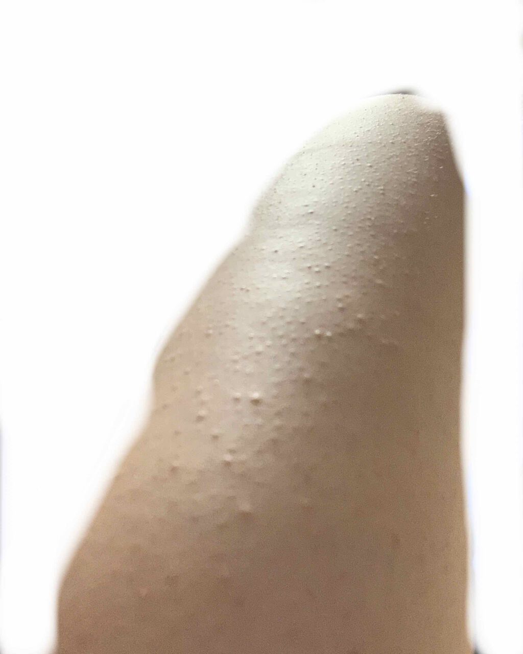 クナイプビオ オイル クナイプを使った口コミ こんばんは 写真ごめんなさい 毛孔性苔癬に By Mizuki 乾燥肌 代後半 Lips