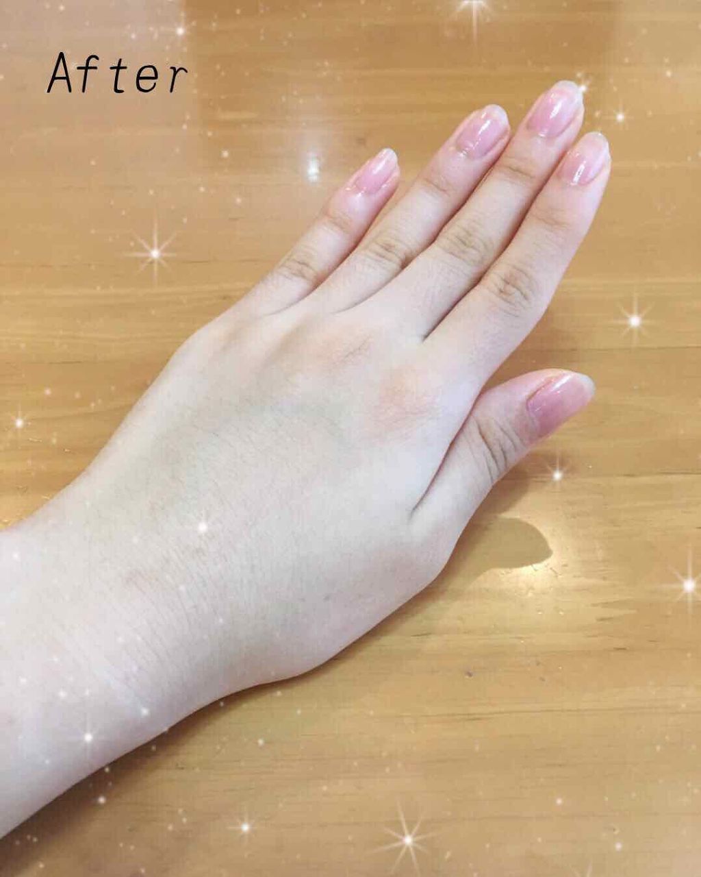 キューティクルトリートメントオイル Dhcの使い方を徹底解説 爪美人になりたい人 すっぴん爪を綺麗にした By 𝚔𝚘𝚑𝚊𝚔𝚞 混合肌 10代後半 Lips