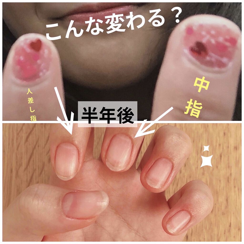 爪 話題沸騰中のコスメ 真似したいメイク方法の口コミが576件 デパコスからプチプラまで Lips